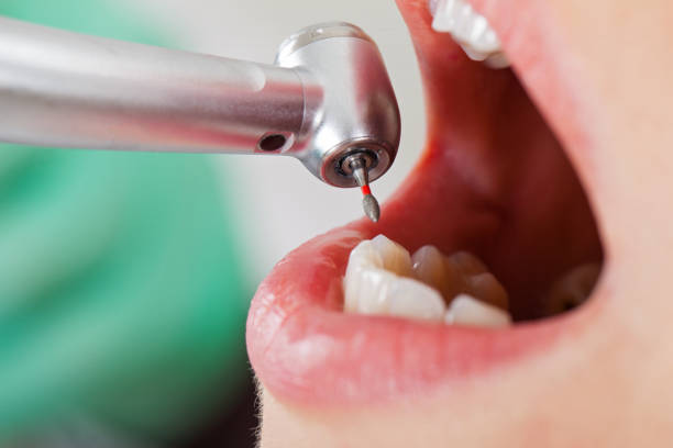 Best Emergency Broken Tooth Repair in Franklin Park, IL